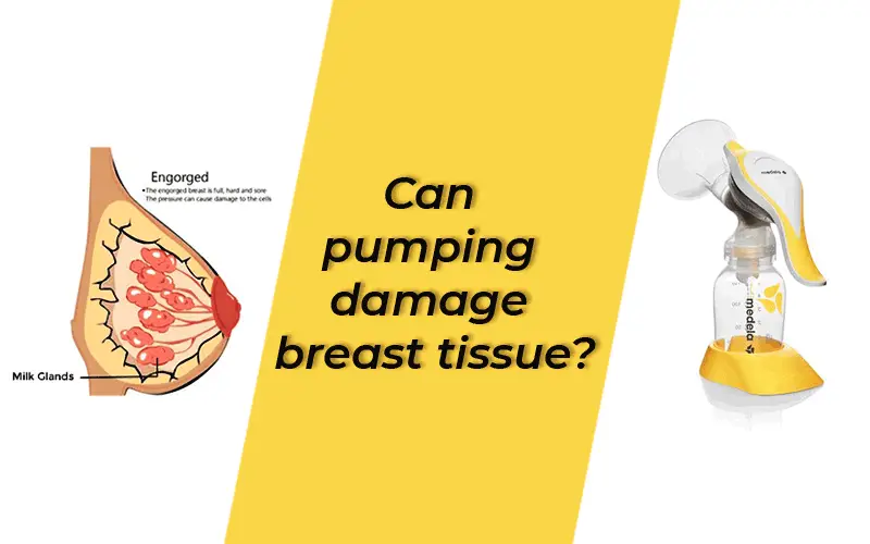 Can pumping damage breast tissue?